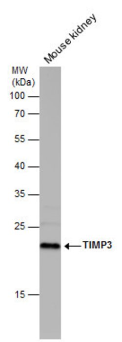 Invitrogen TIMP3 Polyclonal Antibody 100 &mu;L; Unconjugated:Antibodies,
