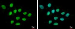 Invitrogen DIS3 Polyclonal Antibody 100 &mu;L; Unconjugated:Antibodies,
