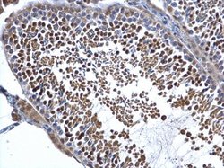 Invitrogen DIS3 Polyclonal Antibody 100 &mu;L; Unconjugated:Antibodies,