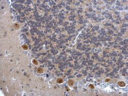 Invitrogen DIS3 Polyclonal Antibody 100 &mu;L; Unconjugated:Antibodies,