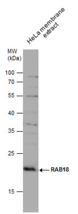 Invitrogen RAB18 Polyclonal Antibody 100 &mu;L; Unconjugated:Antibodies,