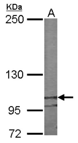 Invitrogen Nesprin 2 Polyclonal Antibody 100 &mu;L; Unconjugated:Antibodies,