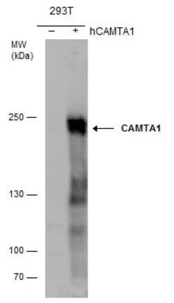 Invitrogen CAMTA1 Polyclonal Antibody 100 &mu;L; Unconjugated:Antibodies,
