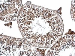 Invitrogen BICD2 Polyclonal Antibody 100 &mu;L; Unconjugated:Antibodies,