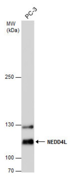 NEDD4L Polyclonal Antibody:Antibodies, Polyclonal