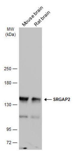 Invitrogen SRGAP2 Polyclonal Antibody 100 &mu;L; Unconjugated:Antibodies,