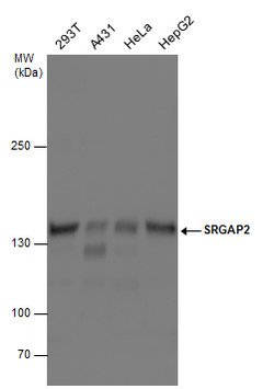 Invitrogen SRGAP2 Polyclonal Antibody 100 &mu;L; Unconjugated:Antibodies,