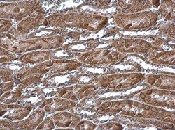 MTCH2 Polyclonal Antibody:Antibodies, Polyclonal