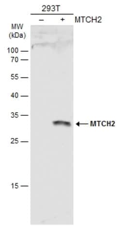MTCH2 Polyclonal Antibody:Antibodies, Polyclonal