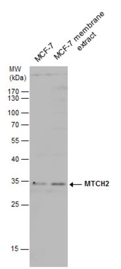 MTCH2 Polyclonal Antibody:Antibodies, Polyclonal