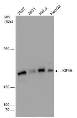 Invitrogen KIF4A Polyclonal Antibody 100 &mu;L | Buy Online | Invitrogen&trade; | Fisher Scientific