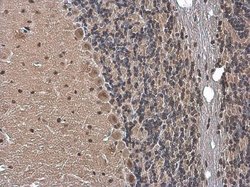 Invitrogen Gemin 5 Polyclonal Antibody 100 &mu;L; Unconjugated:Antibodies,