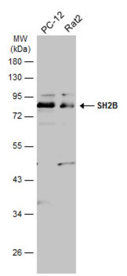 SH2B1 Polyclonal Antibody, Invitrogen 100 &mu;L; Unconjugated:Antibodies,