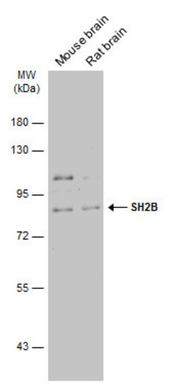 SH2B1 Polyclonal Antibody, Invitrogen 100 &mu;L; Unconjugated:Antibodies,