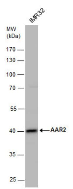 Invitrogen AAR2 Polyclonal Antibody 100 &mu;L; Unconjugated:Antibodies,