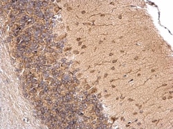 Invitrogen LSM14A Polyclonal Antibody 100 &mu;L; Unconjugated:Antibodies,