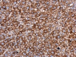 Invitrogen WIPI2 Polyclonal Antibody 100 &mu;L; Unconjugated:Antibodies,