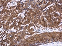 Invitrogen TES Polyclonal Antibody 100 &mu;L; Unconjugated:Antibodies,