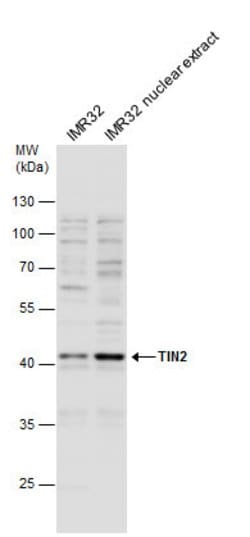 Invitrogen TIN2 Polyclonal Antibody 100 &mu;L; Unconjugated:Antibodies,