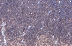 Invitrogen LAT Polyclonal Antibody 100 &mu;L; Unconjugated:Antibodies,