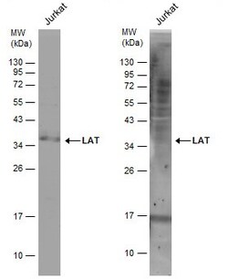 Invitrogen LAT Polyclonal Antibody 100 &mu;L | Buy Online | Invitrogen&trade; | Fisher Scientific