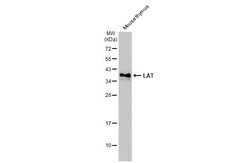 Invitrogen LAT Polyclonal Antibody 100 &mu;L; Unconjugated:Antibodies,