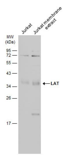 Invitrogen LAT Polyclonal Antibody 100 &mu;L; Unconjugated:Antibodies,