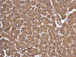 Invitrogen AGO2 Polyclonal Antibody 100 &mu;L; Unconjugated:Antibodies,