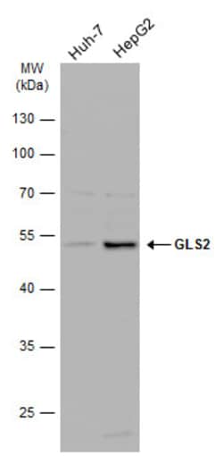 Invitrogen GLS2 Polyclonal Antibody 100 &mu;L; Unconjugated:Antibodies,