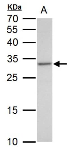 Invitrogen VENTX Polyclonal Antibody 100 &mu;L; Unconjugated:Antibodies,