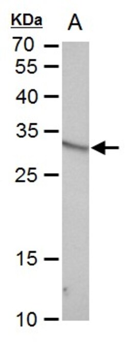 Invitrogen VENTX Polyclonal Antibody 100 &mu;L; Unconjugated:Antibodies,