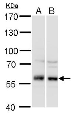 Invitrogen DYNC1LI1 Polyclonal Antibody 100 &mu;L; Unconjugated:Antibodies,