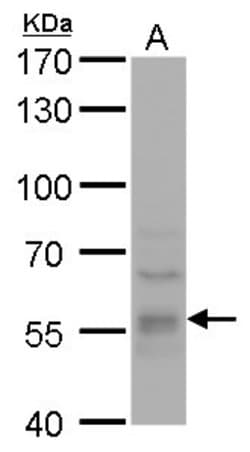 Invitrogen DYNC1LI1 Polyclonal Antibody 100 &mu;L; Unconjugated:Antibodies,