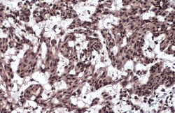 Invitrogen TIF1 gamma Polyclonal Antibody 100 &mu;L; Unconjugated:Antibodies