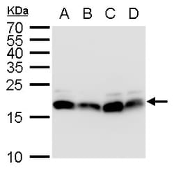 Invitrogen POLE3 Polyclonal Antibody 100 &mu;L; Unconjugated:Antibodies,