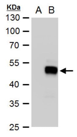 Invitrogen SOX18 Polyclonal Antibody 100 &mu;L; Unconjugated:Antibodies,