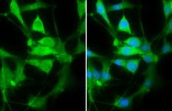 Invitrogen PHD2 Polyclonal Antibody 100 &mu;L; Unconjugated:Antibodies,