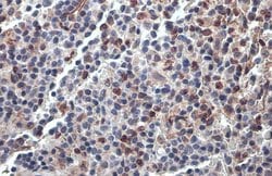 Invitrogen PARP14 Polyclonal Antibody 100 &mu;L; Unconjugated:Antibodies,