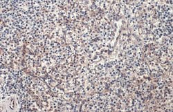 Invitrogen PARP14 Polyclonal Antibody 100 &mu;L; Unconjugated:Antibodies,