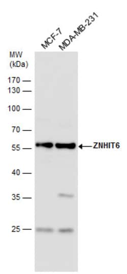 Invitrogen ZNHIT6 Polyclonal Antibody 100 &mu;L; Unconjugated:Antibodies,