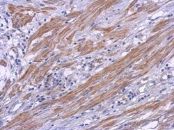Invitrogen CRTAC1 Polyclonal Antibody 100 &mu;L; Unconjugated:Antibodies,