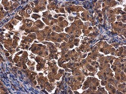 Invitrogen CEP192 Polyclonal Antibody 100 &mu;L; Unconjugated:Antibodies,