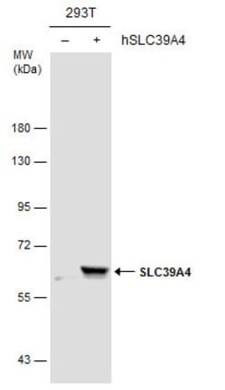 Invitrogen SLC39A4 Polyclonal Antibody 100 &mu;L | Buy Online | Invitrogen&trade; | Fisher Scientific
