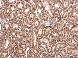 Invitrogen CCAR1 Polyclonal Antibody 100 &mu;L; Unconjugated:Antibodies,