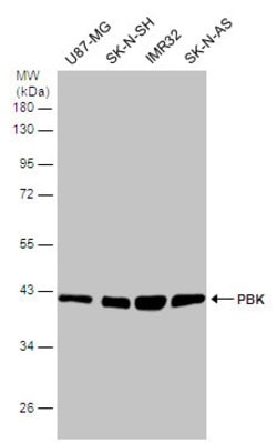 Invitrogen PBK Polyclonal Antibody 100 &mu;L; Unconjugated:Antibodies,