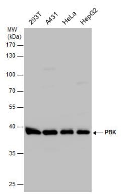 Invitrogen PBK Polyclonal Antibody 100 &mu;L; Unconjugated:Antibodies,