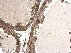 Invitrogen TSG Polyclonal Antibody 100 &mu;L; Unconjugated:Antibodies,