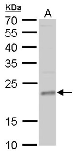 Invitrogen TSG Polyclonal Antibody 100 &mu;L; Unconjugated:Antibodies,