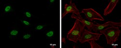 Invitrogen PTBP2 Polyclonal Antibody 100 &mu;L; Unconjugated:Antibodies,