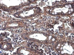 Invitrogen GNB4 Polyclonal Antibody 100 &mu;L; Unconjugated:Antibodies,